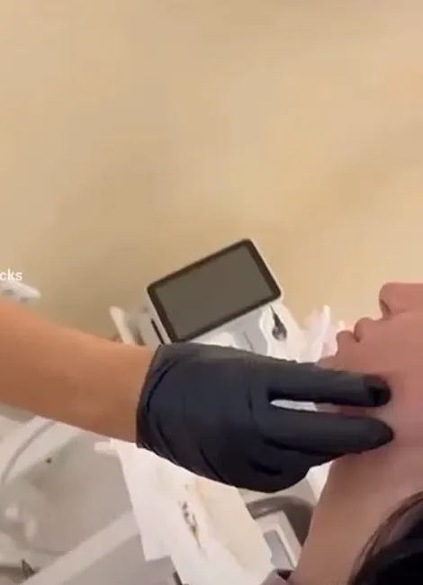 Depilim me laser Diode